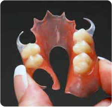 partial denture